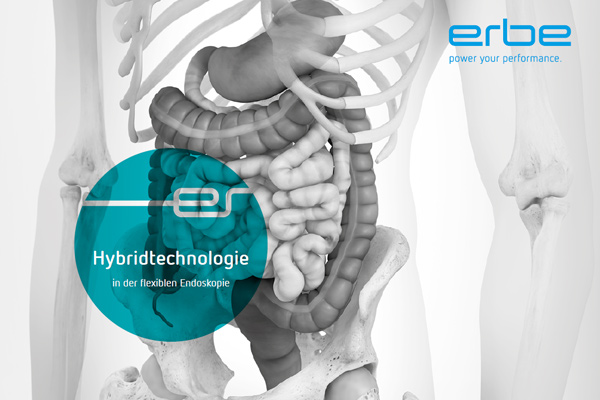 Broschüre Hybridtechnologie